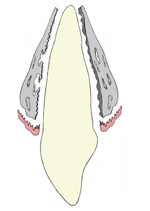 Déplacement des dents Tooth movement Orthodontistes Lemay Une dent doit être soumise à une force pour se déplacer dans l'os qui l'entoure