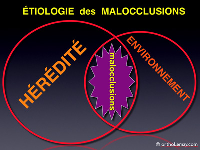 Étiologie cause des malocclusions etiology orthodontiste lemay